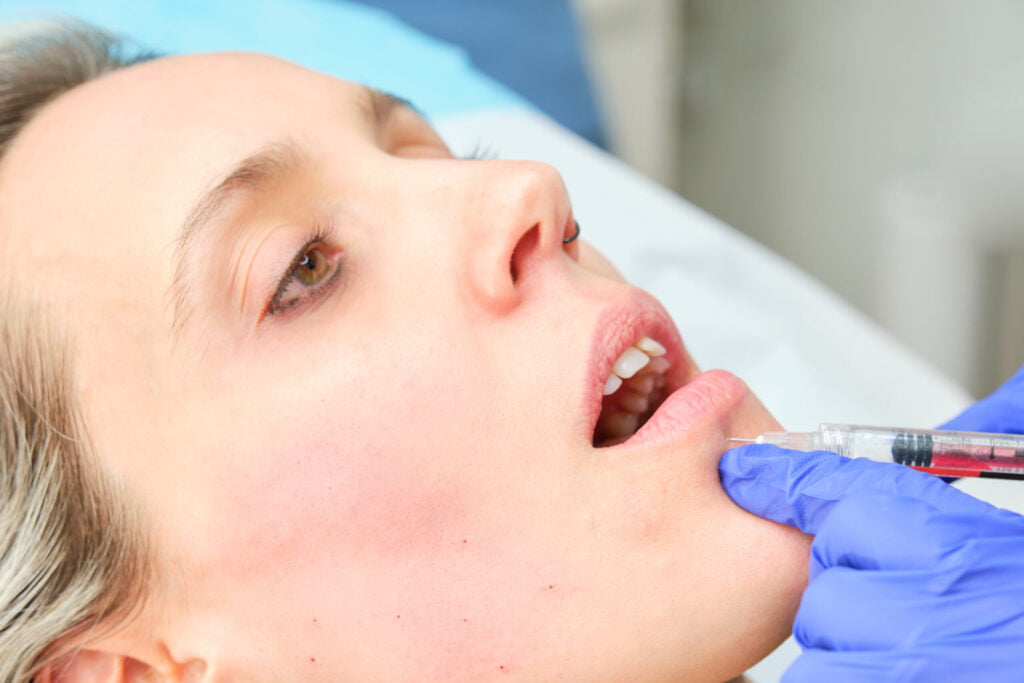 beauty, lower lip augmentation with botulinum toxin utc scaled